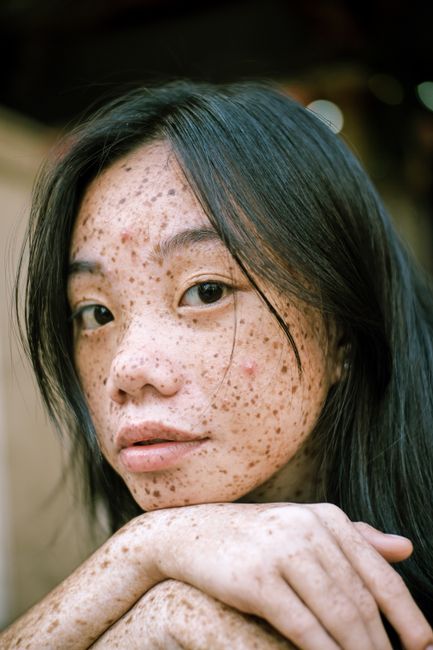 美麗佳人,Marie Claire,痘痘貼,rhode 香蕉皮眼膜